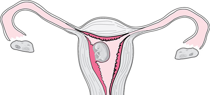 Vagina and Embryo