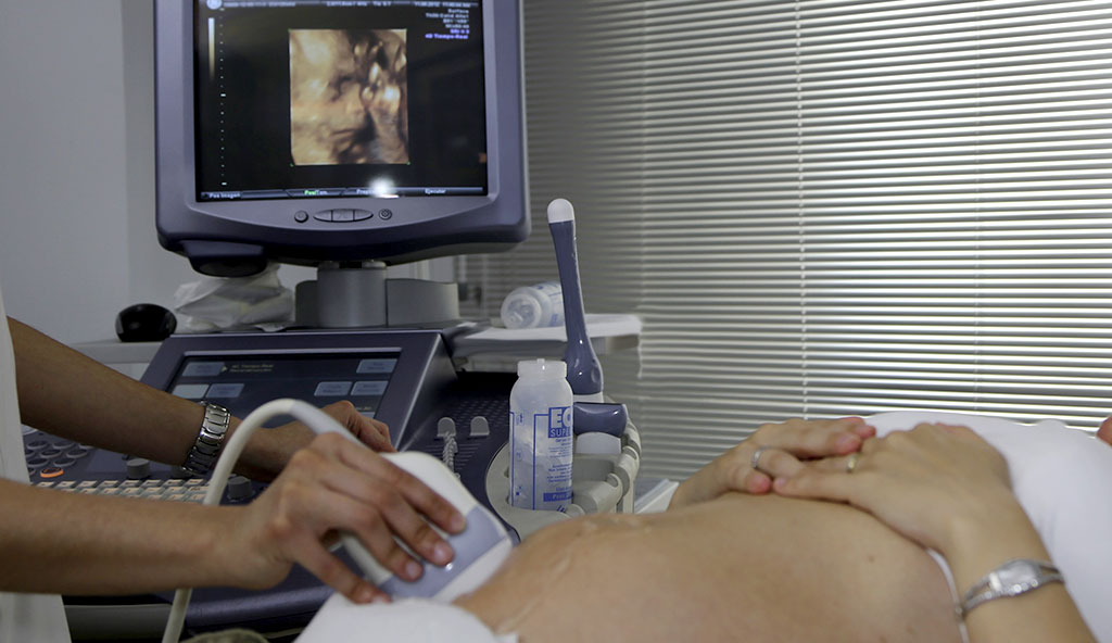 Woman getting an ultrasound